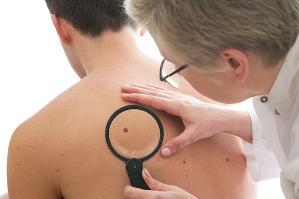 Spotlight on skin cancer