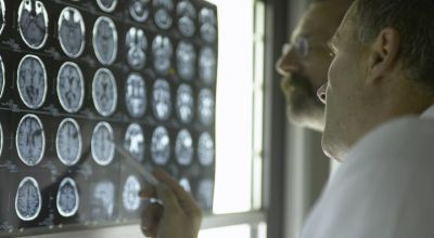 AI could spot Alzheimer’s in MRI scans up to a decade before symptoms show