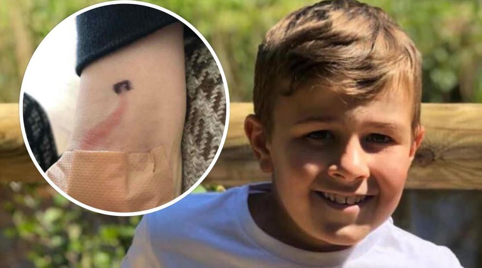 Mum shares sign of “hidden killer” after spotting mark on son’s arm