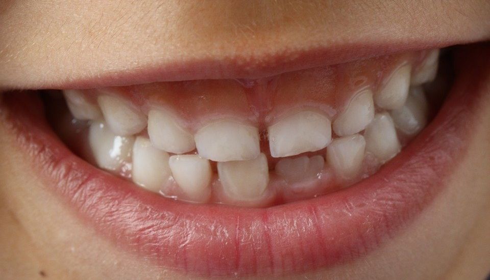 POD: Children's dental 'recovery plan' to start next year