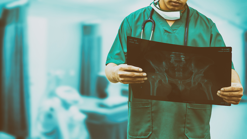 shutterstock xray
