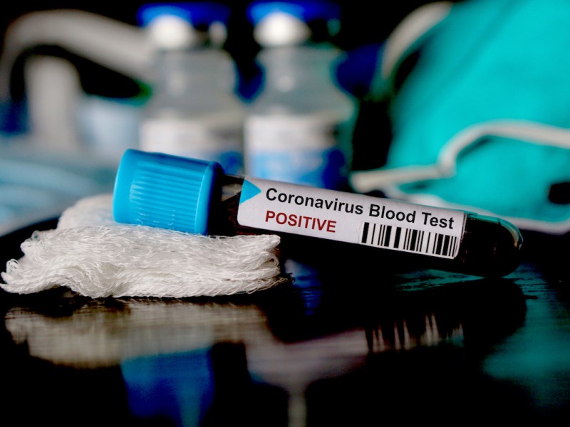 coronaviruscovid19.jpg