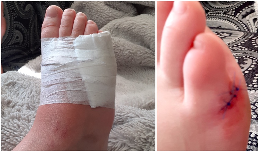 marshallcoronainjury2.jpg