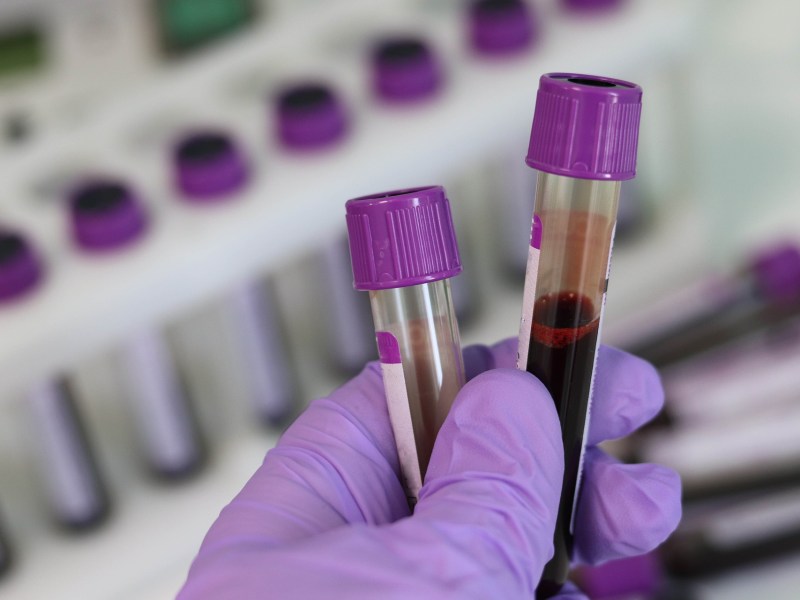 blood_test.jpg