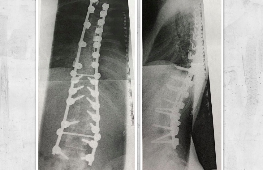 Sophie_Veron_xrays.jpg