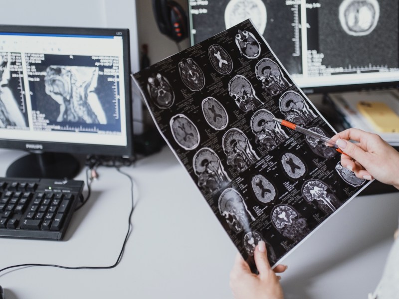 neurology_stock_3.jpg