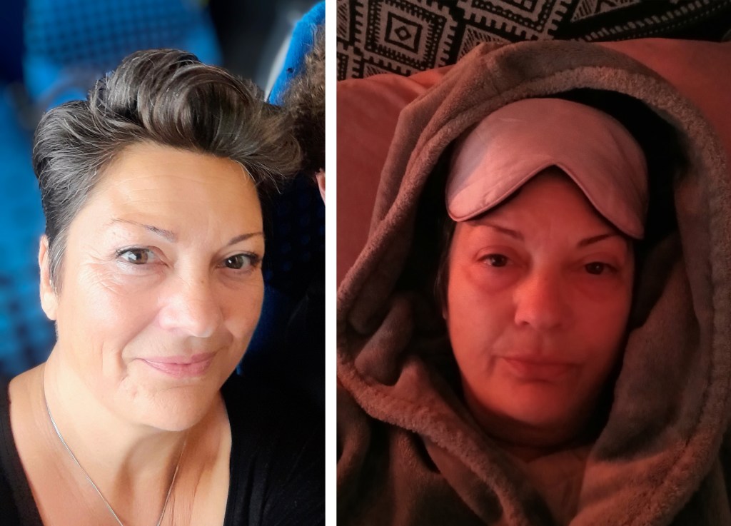 Side-by-side photos showing a woman before she got fibromyalgia seated in a bright train and the woman looking tired and resting while wrapped in a hooded blanket in a dark room after her diagnosis.